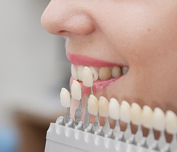 Woman comparing shades of restorations to her teeth