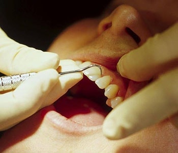 Patient getting gum treatment