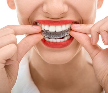 Woman putting in clear aligners