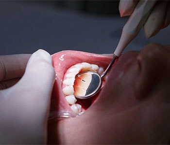 Close-up of patient getting treated for gum disease