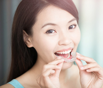 Woman putting in clear aligners