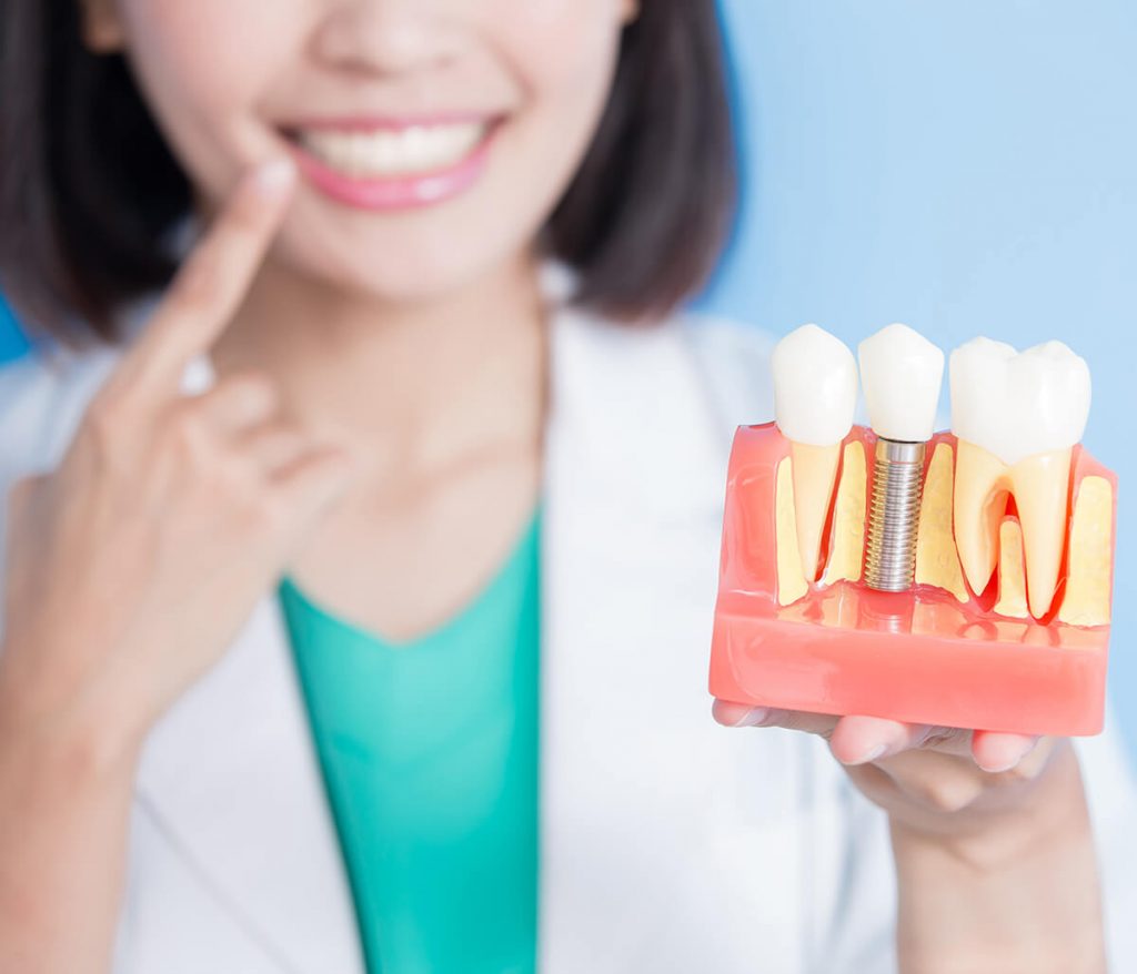 Woman comparing dental implants to her teeth