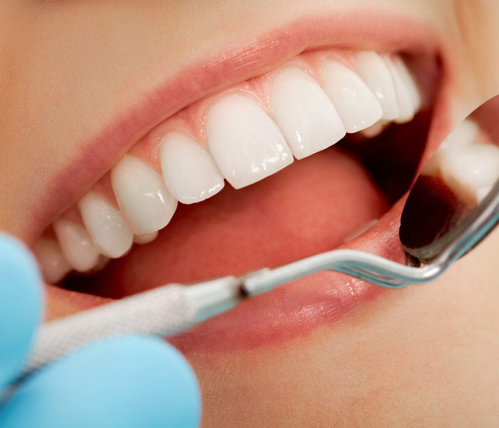 Close-up of woman getting her teeth examined