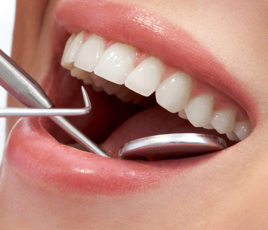 Close-up of woman's teeth getting examined