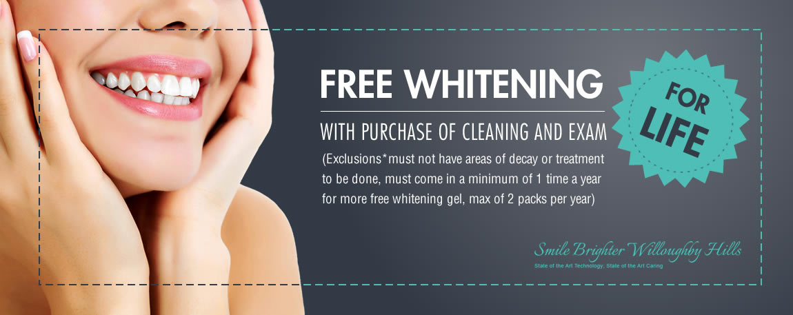 Free teeth whitening advertisement