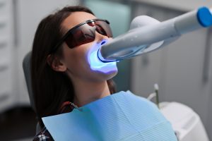 teeth whitening