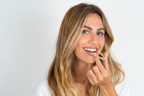 invisalign