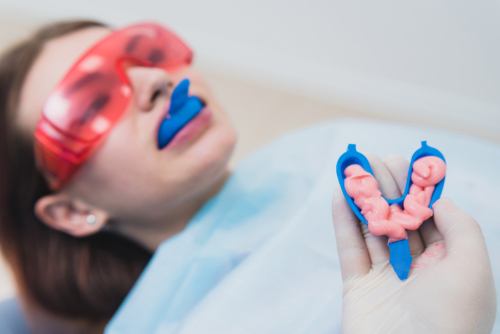 fluoride treatment