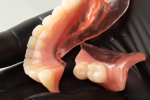 Broken,Lower,Complete,Denture